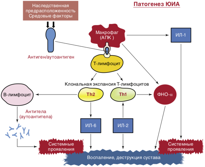 Схема патогенеза идиопатического артрита у детей Патогенез ювенильного идиопатического артрита